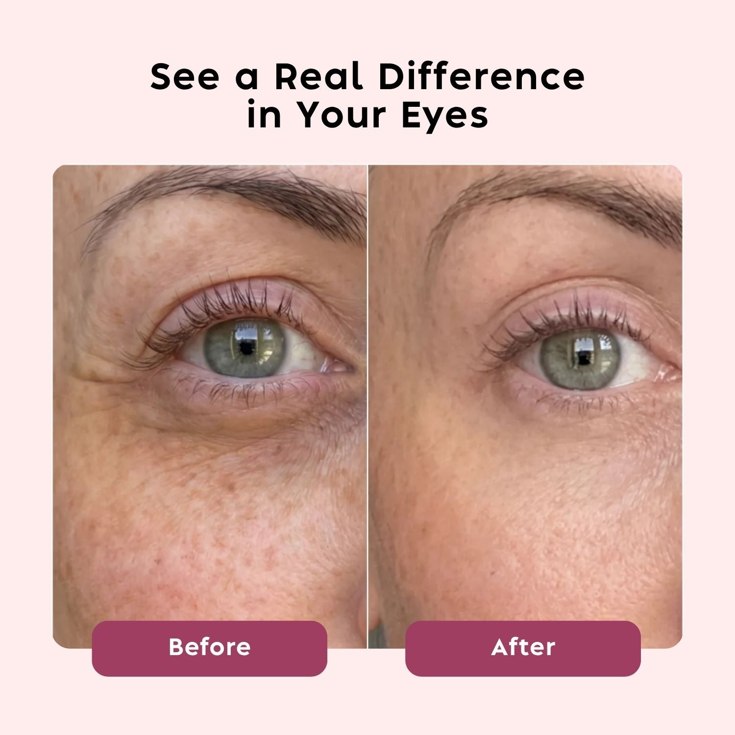 4-1 Eye Wand + Hyaluronic Acid Serum