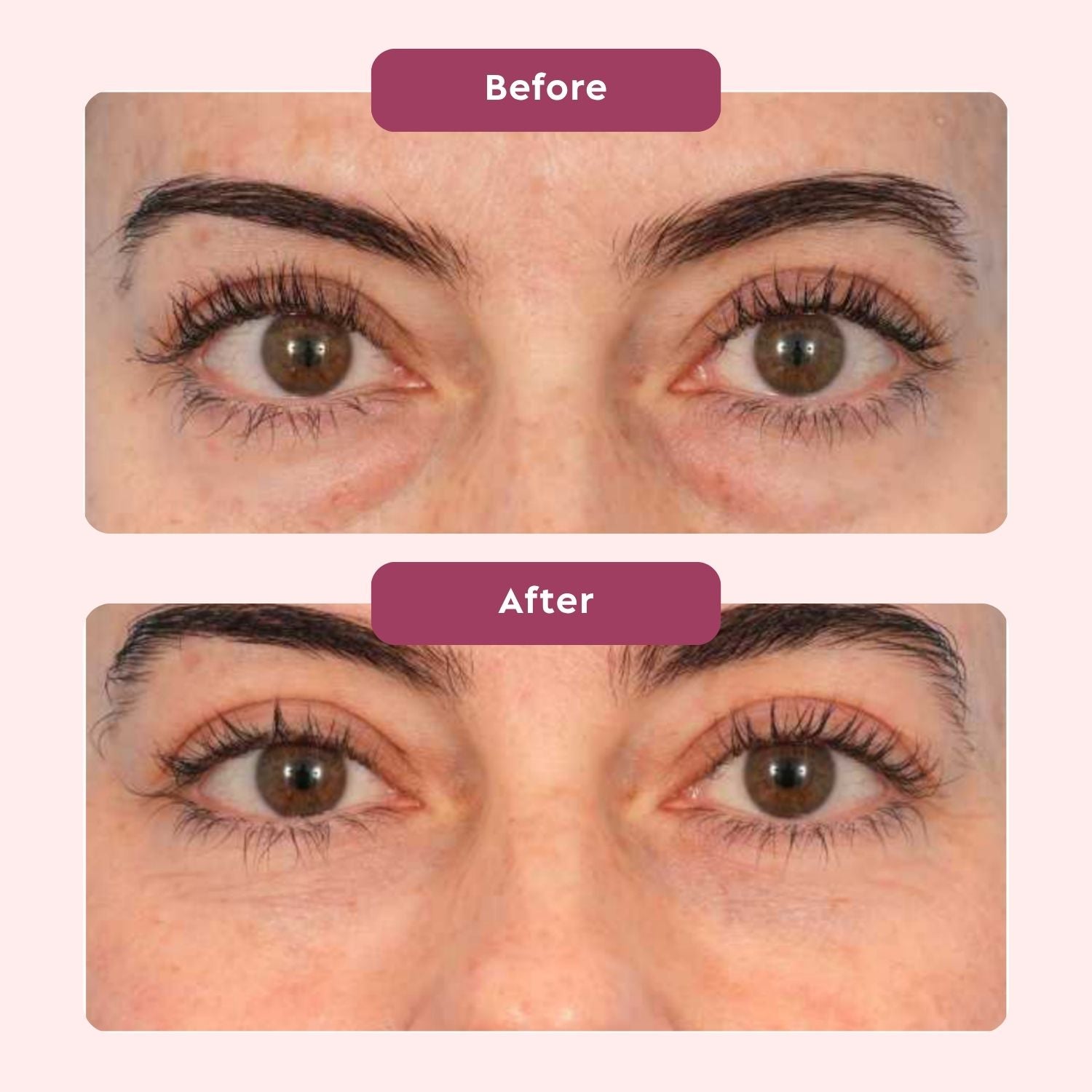 4-1 Eye Wand + Hyaluronic Acid Serum